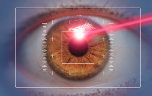 Contoura Vision overview graphic explaining its precision in vision correction