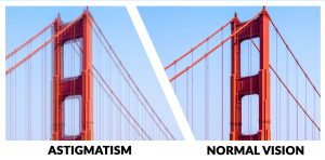 Symptoms of Astigmatism