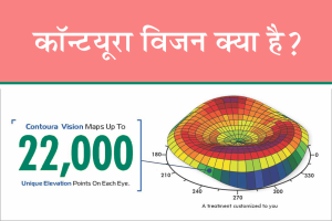 कॉन्ट्यूरा विजन क्या है?