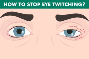 Ways to stop eye twitching