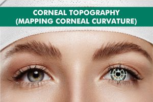 Corneal topography image illustrating its importance in eye examinations and treatments