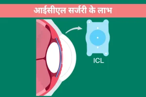 आईसीएल सर्जरी के लाभ